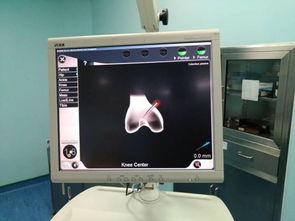 计算机辅助导航技术与移动应用在膝关节置换中的开发与运营体会